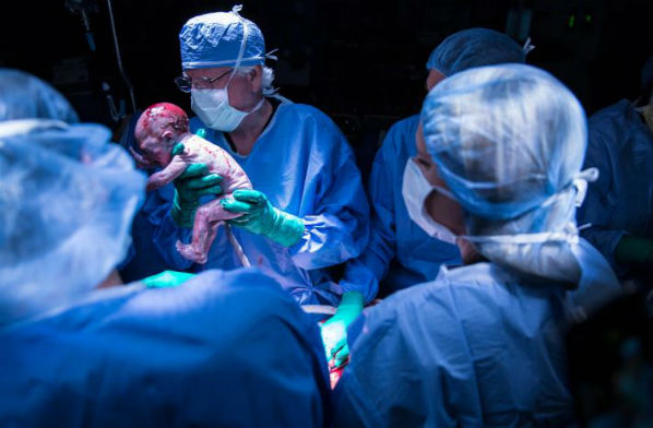 Mulher que recebeu um útero transplantado de uma doadora falecida DEU à LUZ